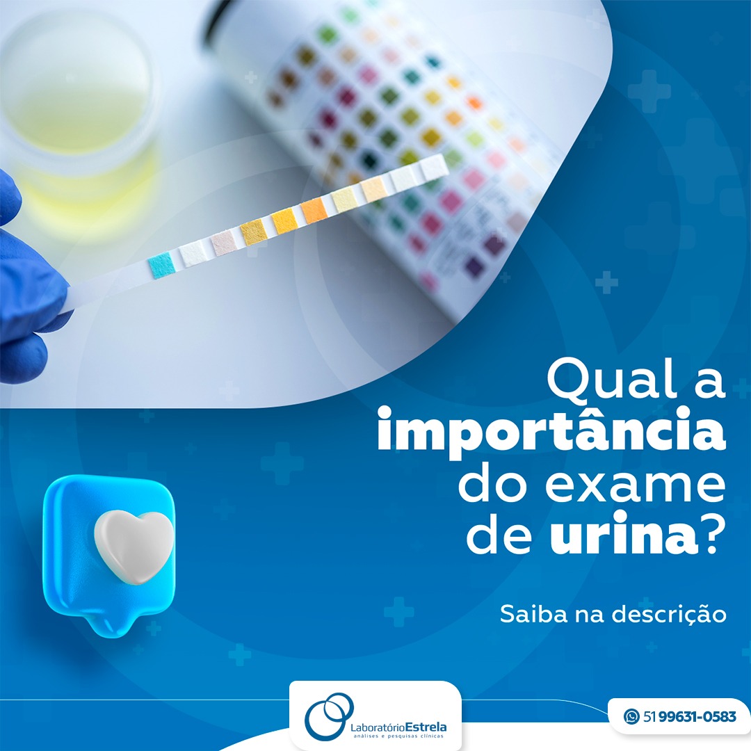 No momento você está vendo Qual a importância do exame de urina?