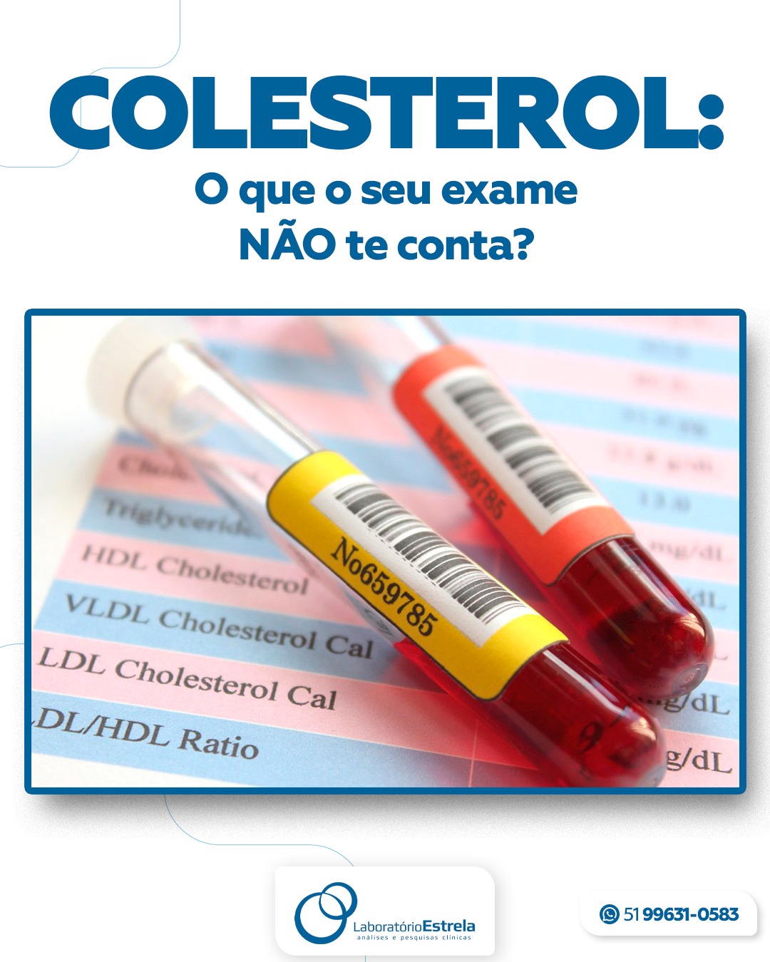 No momento você está vendo COLESTEROL: o que o seu exame não te conta?